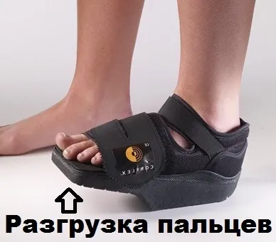 Поперечна плоскостопість симптоми і лікування в Москві, оперативне лікування hallux valgus в москві (плоскостопість) Поперечна плоскостопість симптоми і лікування в Москві, оперативне лікування hallux valgus в москві