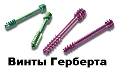 Поперечна плоскостопість симптоми і лікування в Москві, оперативне лікування hallux valgus в москві (поперечне) Поперечна плоскостопість симптоми і лікування в Москві, оперативне лікування hallux valgus в москві