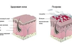 Підвищення імунітету у літніх людей