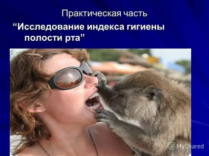 Презентація на тему карієс зубів (впливу навколишнього середовища емаль) Презентація на тему карієс зубів