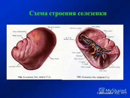 Презентація на тему тема ультразвукова діагностика захворювань селезінки лекція 22 для слухачів