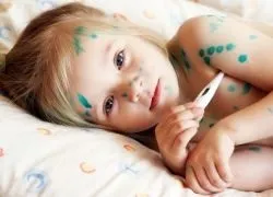 Ознаки вітрянки у дітей