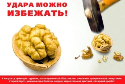 Профілактика інсульту головного мозку (ішемічного або геморагічного) препарати і народні (профілактика) Профілактика інсульту головного мозку (ішемічного або геморагічного) препарати і народні