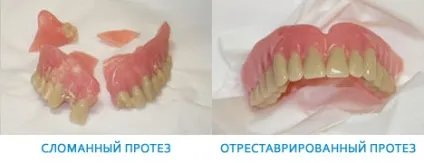 Ремонт зубних протезів в домашніх умовах можливо їх склеїти (умовах) Ремонт зубних протезів в домашніх умовах можливо їх склеїти