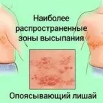 Найефективніші народні засоби для швидкого лікування гіпертонії в домашніх умовах (ефективні) Найефективніші народні засоби для швидкого лікування гіпертонії в домашніх умовах