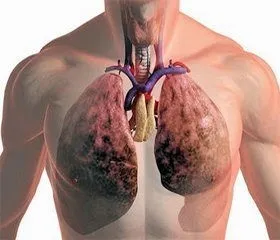 Сердечно легенева недостатність симптоми і лікування