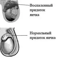 Скільки не пити перед зачаттям чоловікові і наскільки це важливо (скільки) Скільки не пити перед зачаттям чоловікові і наскільки це важливо