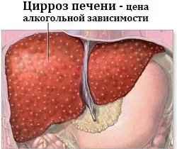 Синдром відміни алкоголю лікування, симптоми, скільки триває (симптоми) Синдром відміни алкоголю лікування, симптоми, скільки триває