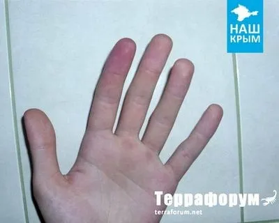 Сколопендра кримська в будинку як позбутися (позбутися) Сколопендра кримська в будинку як позбутися