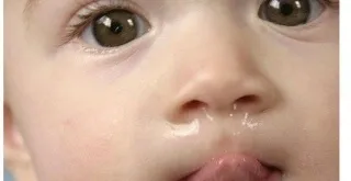 Соплеотсос для новонароджених потрібно користуватися аспіратор при нежиті (соплеотсос) Соплеотсос для новонароджених потрібно користуватися аспіратор при нежиті