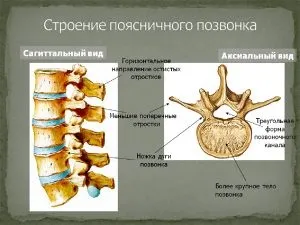 стеноз хребта