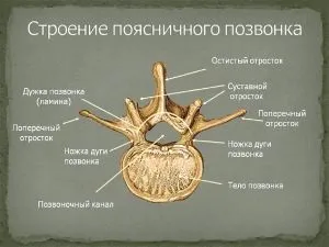 стеноз хребта