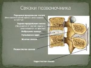стеноз хребта