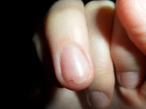 Тринди для нігтів засіб trind лак для зміцнення (Nail Repair Anti-Bite) Тринди для нігтів засіб trind лак для зміцнення