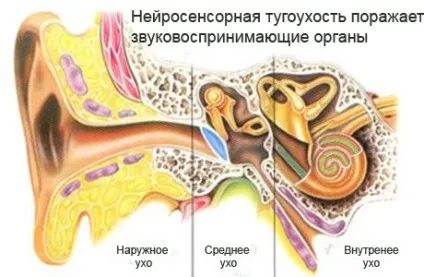 Туговухість - причини, ознаки, симптоми і лікування (відновити слухову функцію) Туговухість - причини, ознаки, симптоми і лікування