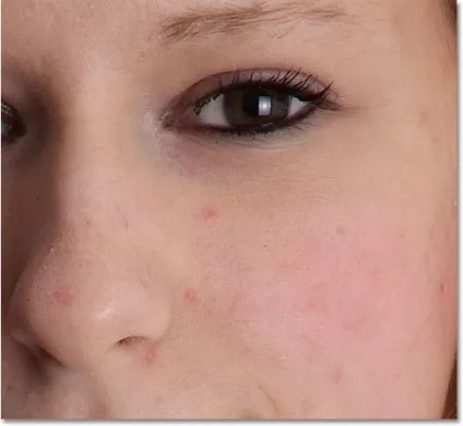 Видалення дефектів шкіри інструментом spot healing brush, уроки (spot) Видалення дефектів шкіри інструментом spot healing brush, уроки