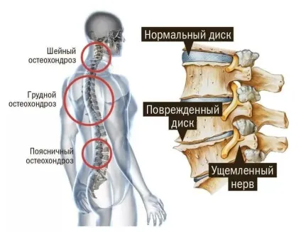 Поліпшення пам'яті народними засобами в домашніх умовах (поліпшення пам'яті народними засобами в домашніх умовах) Поліпшення пам'яті народними засобами в домашніх умовах