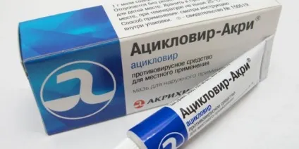 Вітряна віспа у дітей фото, симптоми і лікування, щеплення (вітряна віспа у дітей фото) Вітряна віспа у дітей фото, симптоми і лікування, щеплення