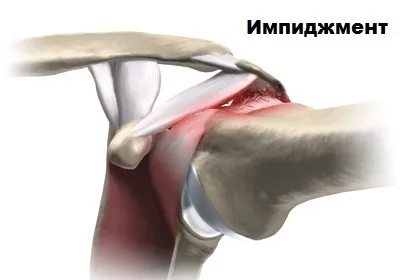 Обертальна (ротаторна) манжета плечового суглоба (плечового) Обертальна (ротаторна) манжета плечового суглоба