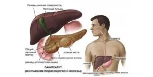 У животі різі і пронос (пронос) У животі різі і пронос