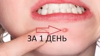 Змова для загоєння ран