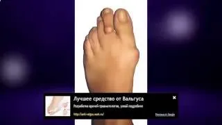 Змова від кісточки і шишок на нозі