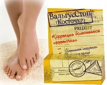 Змова від кісточки на нозі, як заговорити шишки на ногах (змова) Змова від кісточки на нозі, як заговорити шишки на ногах