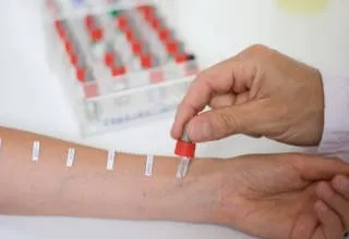 Алергія на яловичину - симптоми і лікування дитини і дорослого (симптоми) Алергія на яловичину - симптоми і лікування дитини і дорослого