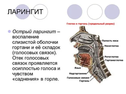 Болить горло ночами і вечорами, а вдень немає - причини (біль) Болить горло ночами і вечорами, а вдень немає - причини