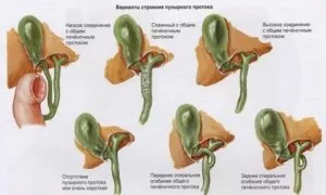 Дискінезія жовчовивідних шляхів у дітей причини, симптоми і лікування (причини) Дискінезія жовчовивідних шляхів у дітей причини, симптоми і лікування