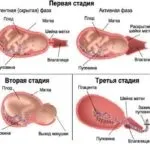 Ергометрин інструкція із застосування, ціна, відгуки та аналоги (ергометрін) Ергометрин інструкція із застосування, ціна, відгуки та аналоги