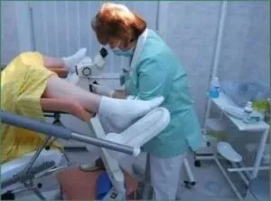 Ерозія шийки матки - причини, симптоми, лікування (ерозія) Ерозія шийки матки - причини, симптоми, лікування