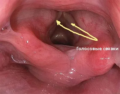 Голосові зв'язки людини (людини) Голосові зв'язки людини