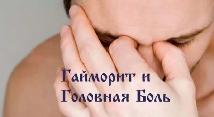 Головний біль при гаймориті - симптоми, що робити, ніж лікувати (гаймориті) Головний біль при гаймориті - симптоми, що робити, ніж лікувати