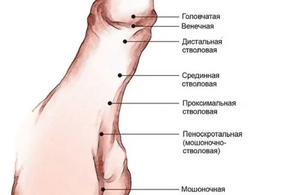 Гипоспадія причини, лікування, ускладнення, профілактика (отвору сечовипускального каналу) Гипоспадія причини, лікування, ускладнення, профілактика