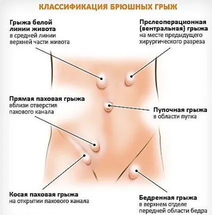Грижового центр мц біосс на біговій (біосс) Грижового центр мц біосс на біговій