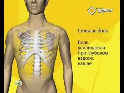 Як визначити перелом ребра або забій 1 (визначити перелом ребра) Як визначити перелом ребра або забій 1