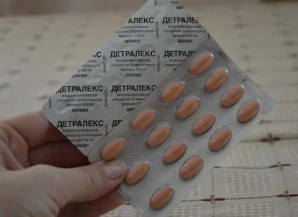 Як зняти запалення вен - причини, симптоми, лікування, профілактика (запалення) Як зняти запалення вен - причини, симптоми, лікування, профілактика