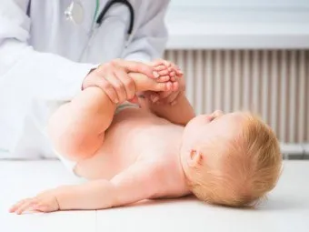 Лікування підвивиху кульшового суглоба у дітей має починатися з моменту його виявлення (підвивиху) Лікування підвивиху кульшового суглоба у дітей має починатися з моменту його виявлення