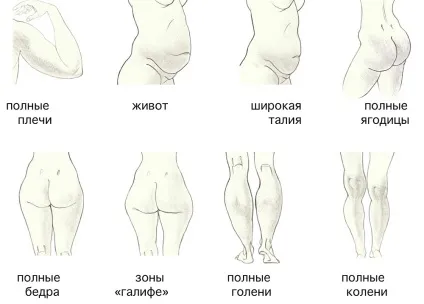 Ліпосакція зон тіла