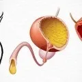 Народне лікування циститу у дітей (циститу) Народне лікування циститу у дітей