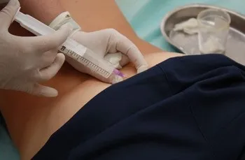 Озонотерапія при остеохондрозі - чи буде результат (озонованого фізіологічного розчину) Озонотерапія при остеохондрозі - чи буде результат