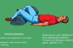Перелом сідничної кістки симптоми і лікування (удари) Перелом сідничної кістки симптоми і лікування