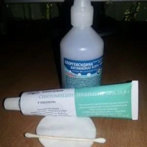 Чому опухає і болить мочка вуха що робити для усунення цих симптомів (мочка) Чому опухає і болить мочка вуха що робити для усунення цих симптомів
