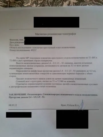 Посмикування м'язів по всьому тілу - відповіді і поради (посмикування м'язів обставини) Посмикування м'язів по всьому тілу - відповіді і поради
