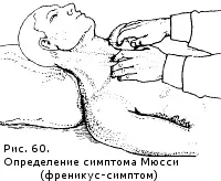 Ознаки захворювань жовчного міхура