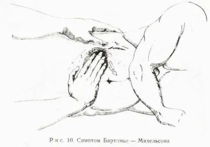 Ознаки захворювань жовчного міхура