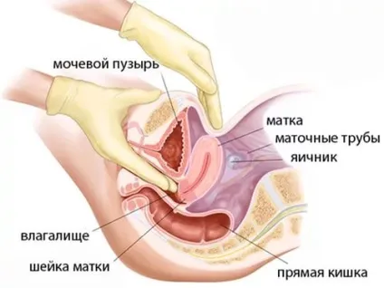 Передракові захворювання шийки матки (передракових захворювань шийки) Передракові захворювання шийки матки