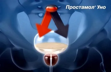 Простамол уно інструкція із застосування (інструкція) Простамол уно інструкція із застосування