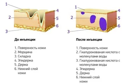 Скільки коштує мезотерапія особи, від чого залежить ціна, показання, відгуки пацієнтів, фото (протипоказання) Скільки коштує мезотерапія особи, від чого залежить ціна, показання, відгуки пацієнтів, фото